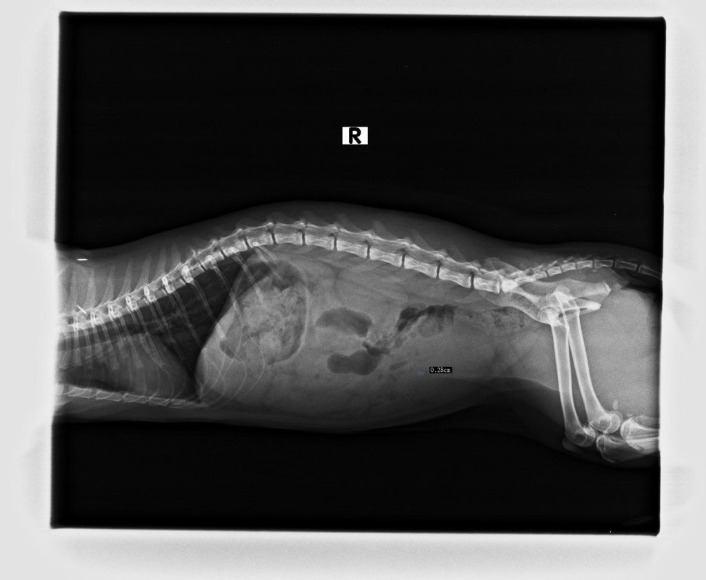 X光片顯示有結石