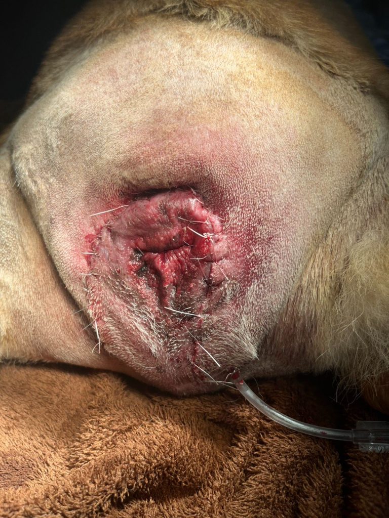 術後安裝引流管